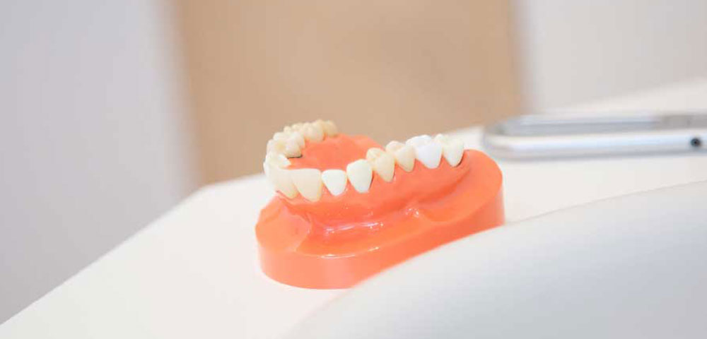 歯専門歯科技工士