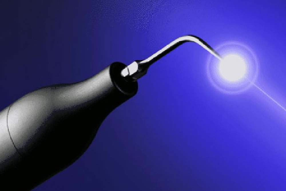 ブルーラジカル